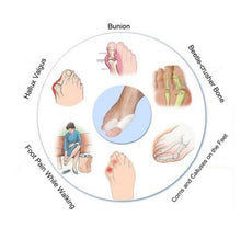 Load image into Gallery viewer, 2pcs Silicone Gel Bunion Toe Corrector